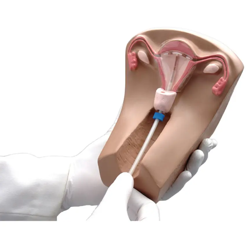 گذاشتن IUD