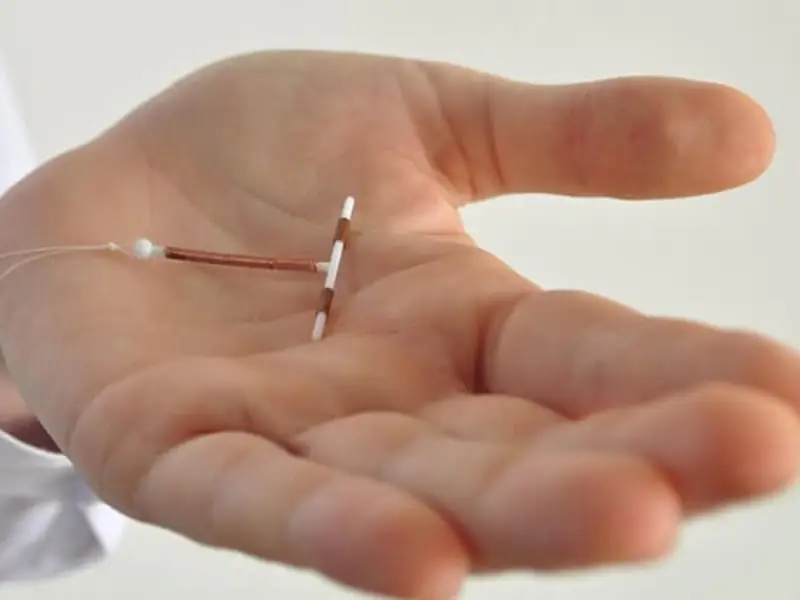 برداشتن IUD